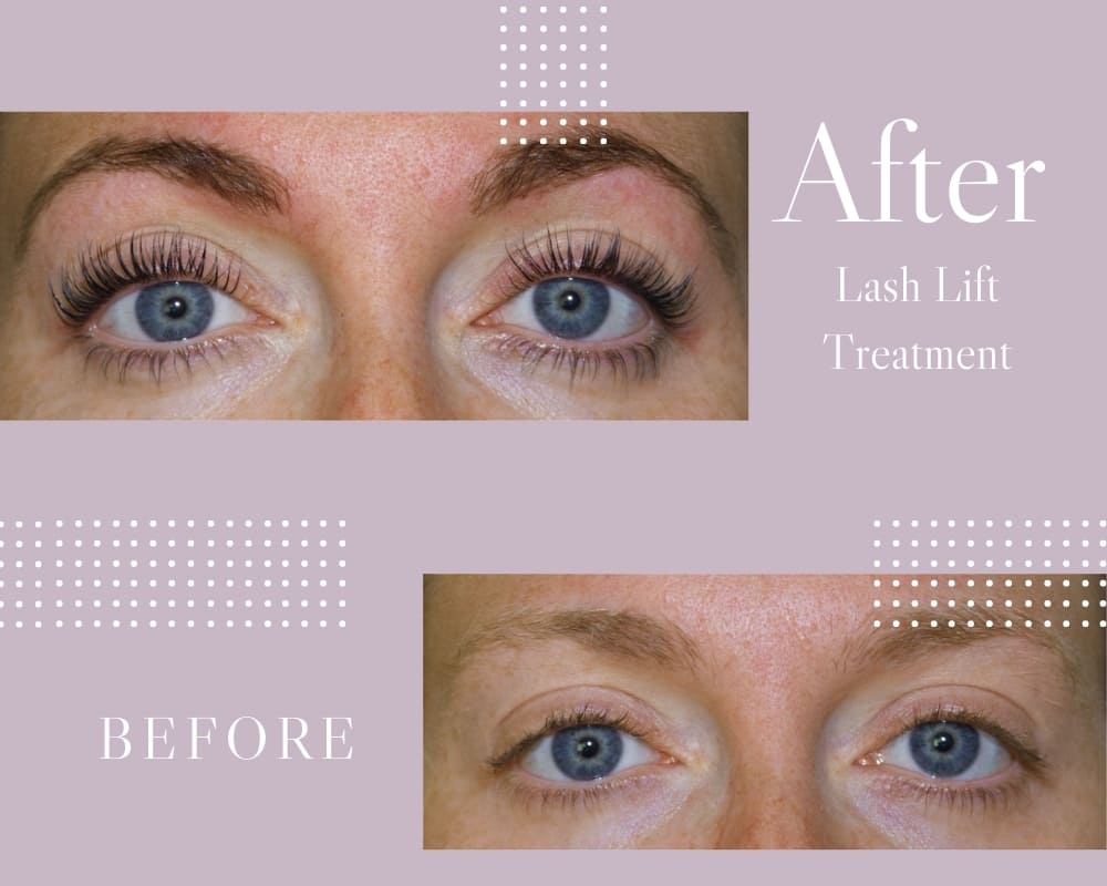 Vorher - Nachher Ergebnisse mit dem Lash Lift Set Vorher - Nachher Ergebnisse mit dem Lash Lift Set